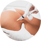 ID V逻辑身体PT注射个性化治疗的图片