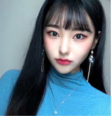 通过轮廓肉毒去除脸部脂肪后拥有V脸的模特