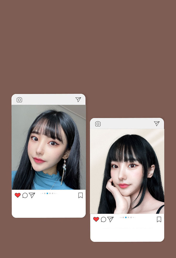 SNS上发布的id轮廓4项术后变化内容