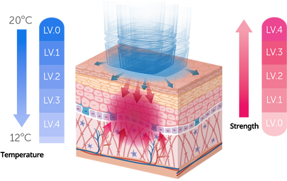 通过水冷却和震动等级保护皮肤表面 缩短恢复期的提升治疗