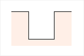 毛孔和疤痕的不同形状-冰锥形 圆盘形 盒子形