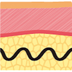 从第一代到第四代逐步升级的线雕结构