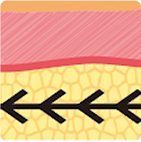 从第一代到第四代逐步升级的线雕结构