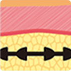 从第一代到第四代逐步升级的线雕结构