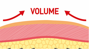 说明不同于普通线雕 可移动锥体避免神经刺激的原理